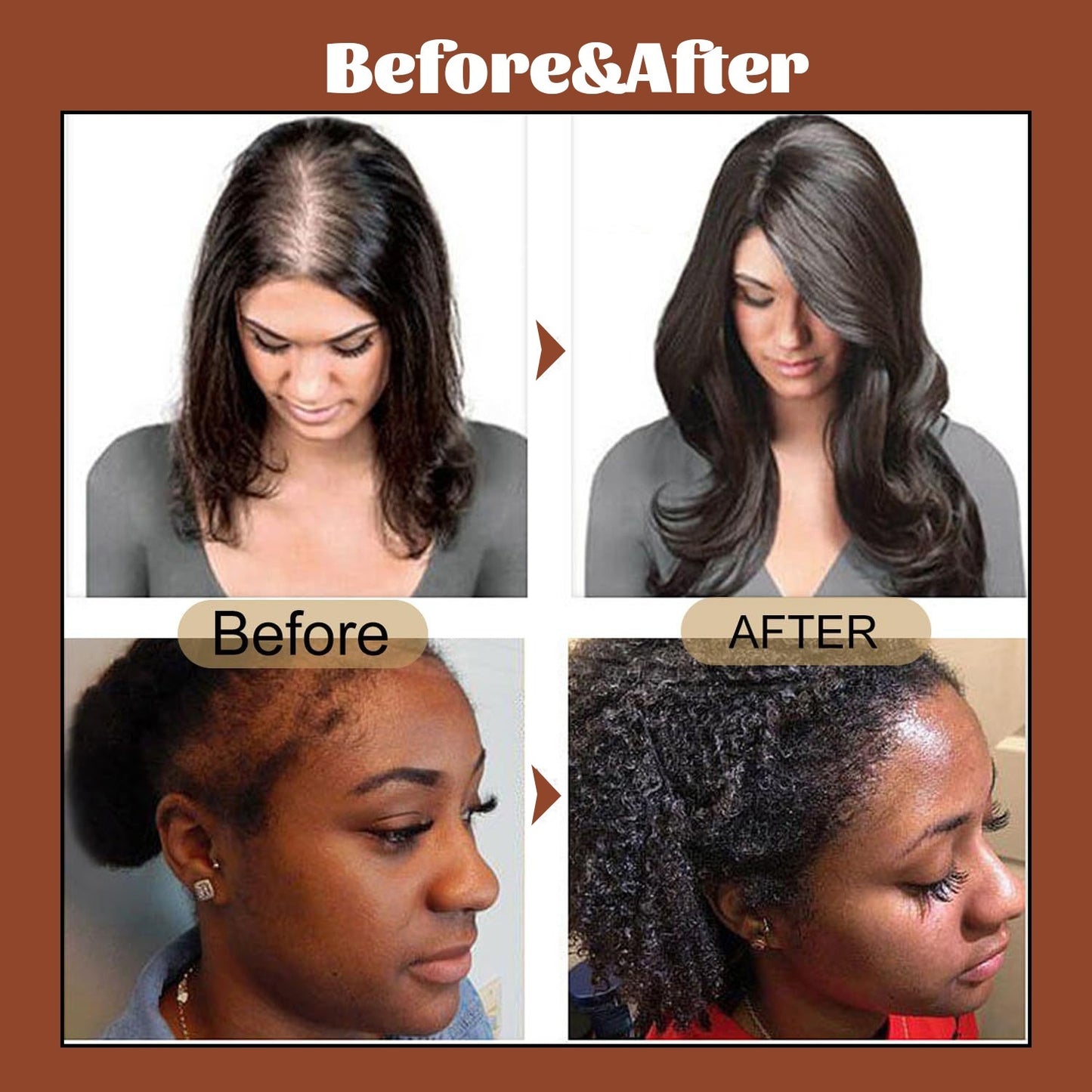 Promote Hair Growth And Care With Hair Oil - Diafro Store