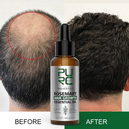 PURC Rosemary Hair Care Essential Oil Ginger Head - Diafro Store 
