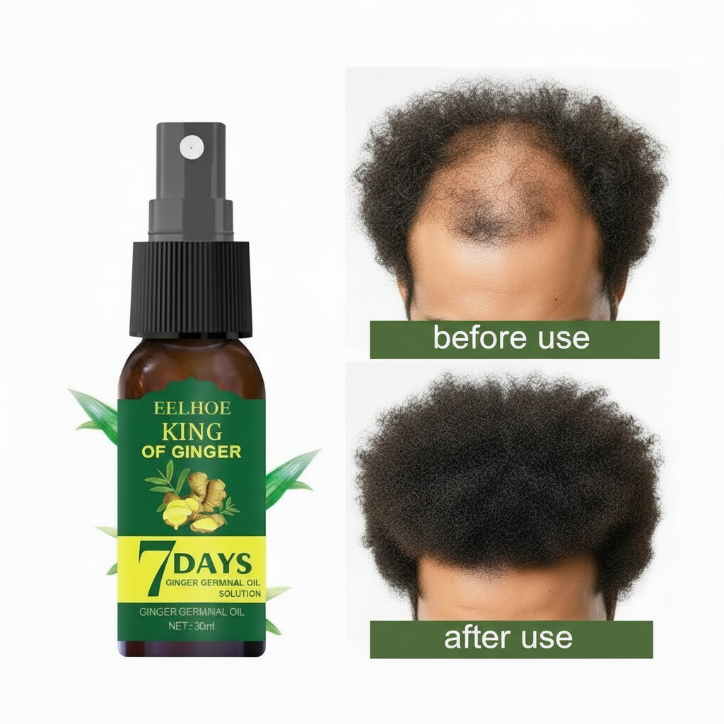 EELHOE Foreign Trade Cross-border Ginger Nutrition Spray Ginger Hair Root Spray Moisturizing Hair Hair Care Spray Spray